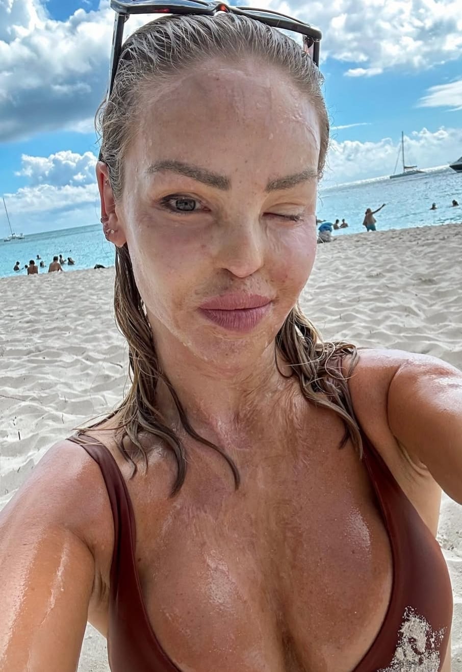 Katie Piper: „Mam dość”